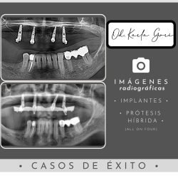 karla-gori-odontologia-bogota-colombia-cedritos-cirugia-oral-1