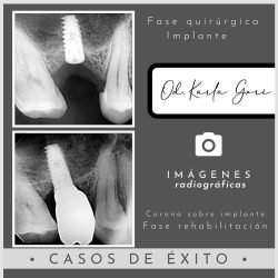karla-gori-odontologia-bogota-colombia-cedritos-cirugia-oral-3