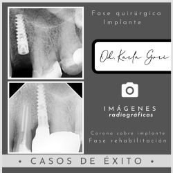 karla-gori-odontologia-bogota-colombia-cedritos-cirugia-oral-5