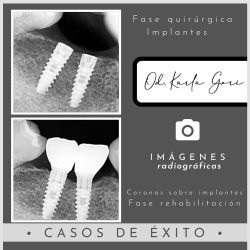 karla-gori-odontologia-bogota-colombia-cedritos-cirugia-oral-6