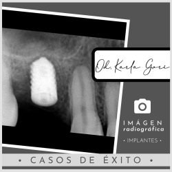 karla-gori-odontologia-bogota-colombia-cedritos-cirugia-oral